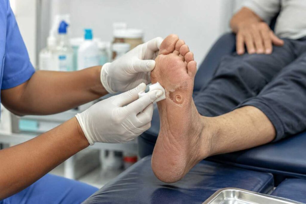 Diabetic Foot Ulcer