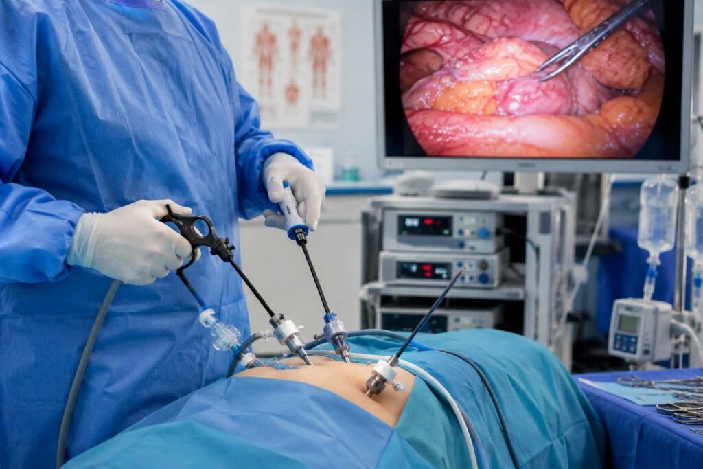 Minimally Invasive Surgery
