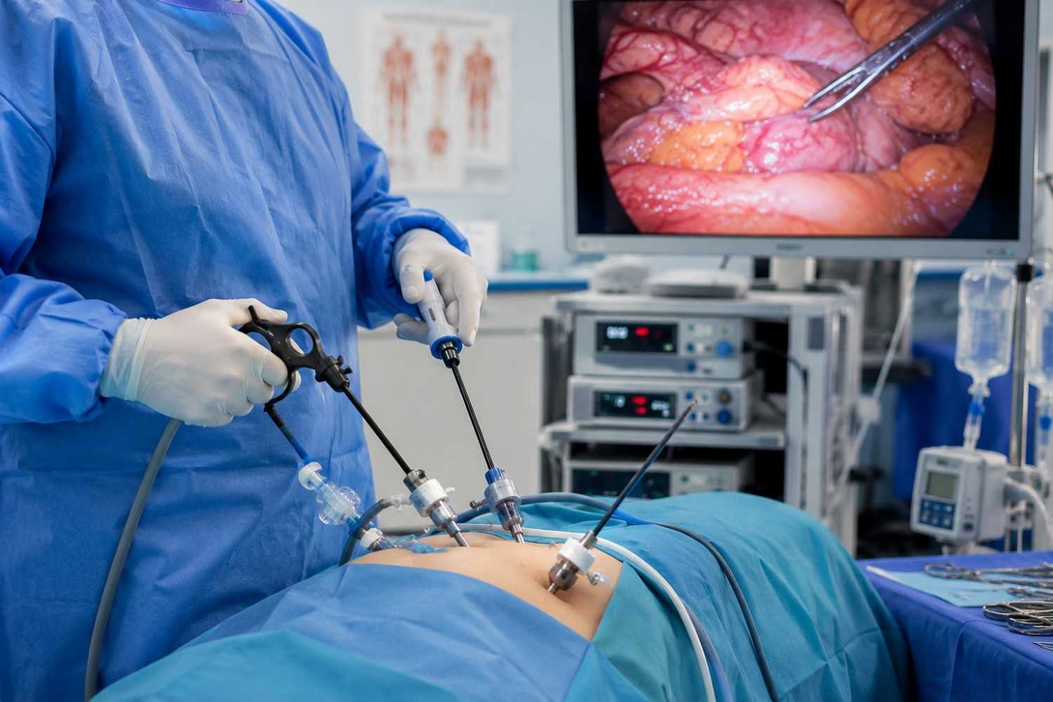 Minimally Invasive Surgery