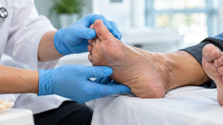 Diabetic Foot Neuropathy in Bangalore